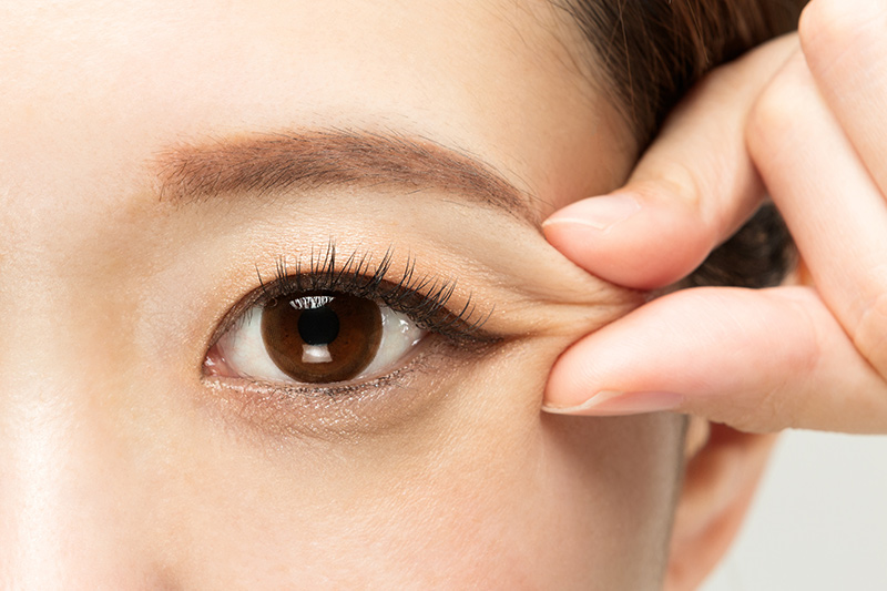 A woman preparing for her double eyelid surgery
