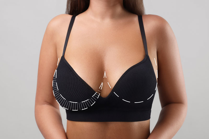 A woman with asymmetrical breasts