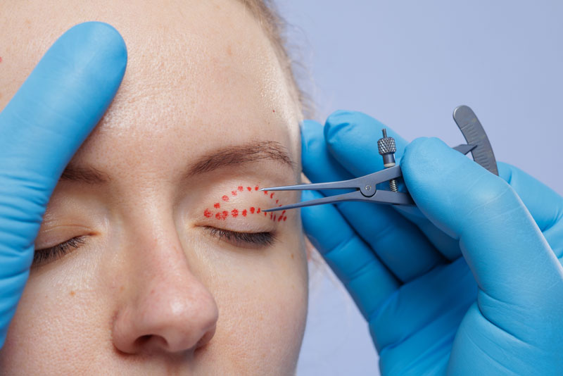 A cosmetic surgeon taking measurements before a procedure