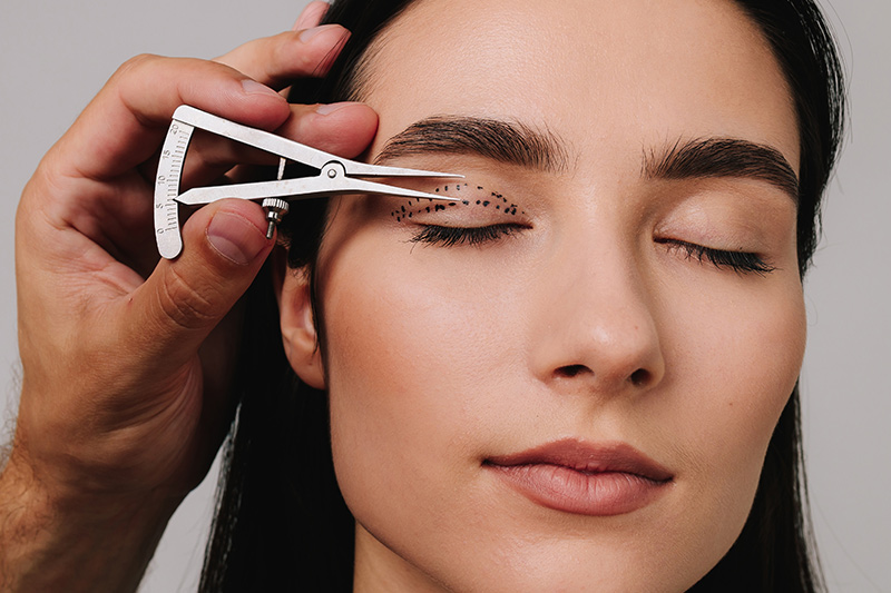 A woman having her eyelids marked for surgery