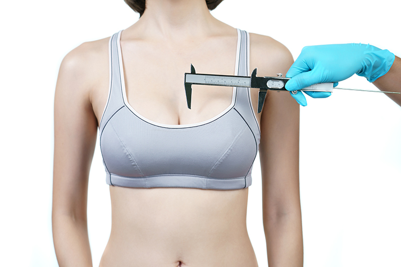 Doctor measuring a woman's bust size for breast reduction surgery