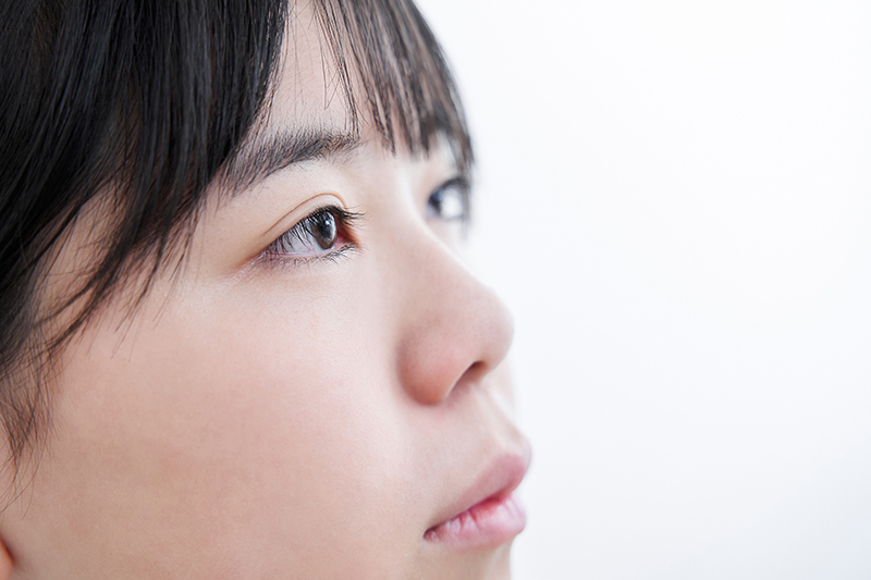 Woman with double eyelids after a surgery